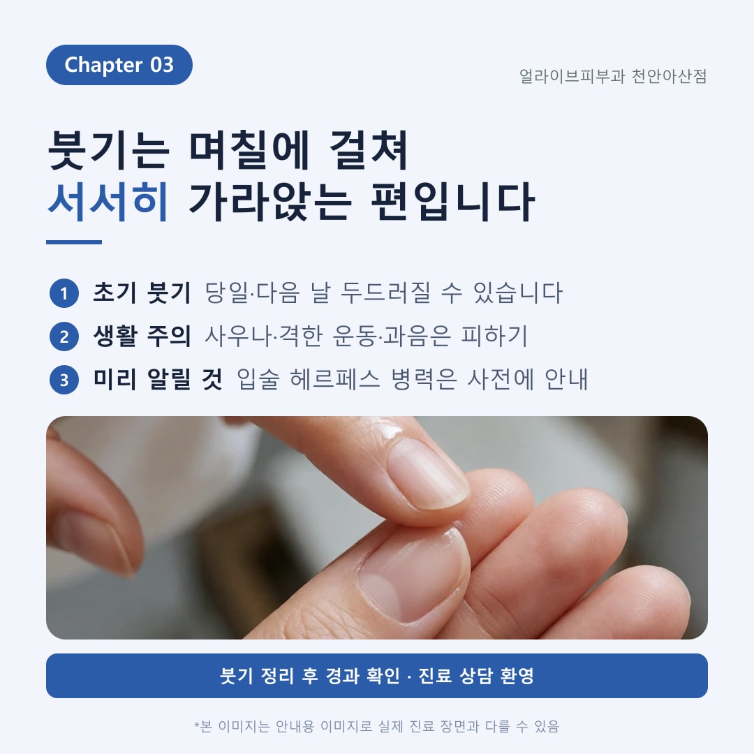아산피부과 입술필러 안내 4