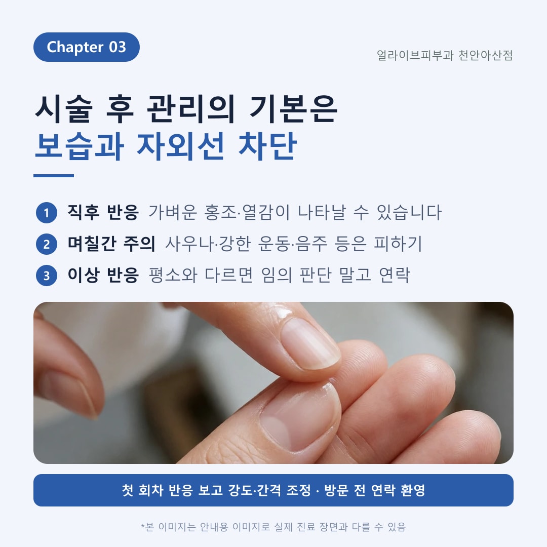 아산피부과 힐로웨이브 원리와 선택 기준 안내 4