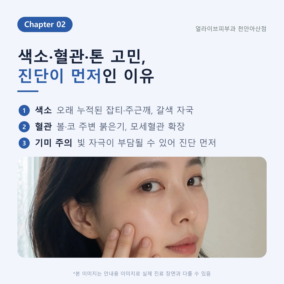 아산피부과 BBL레이저 색소·홍조 광선치료 안내 3