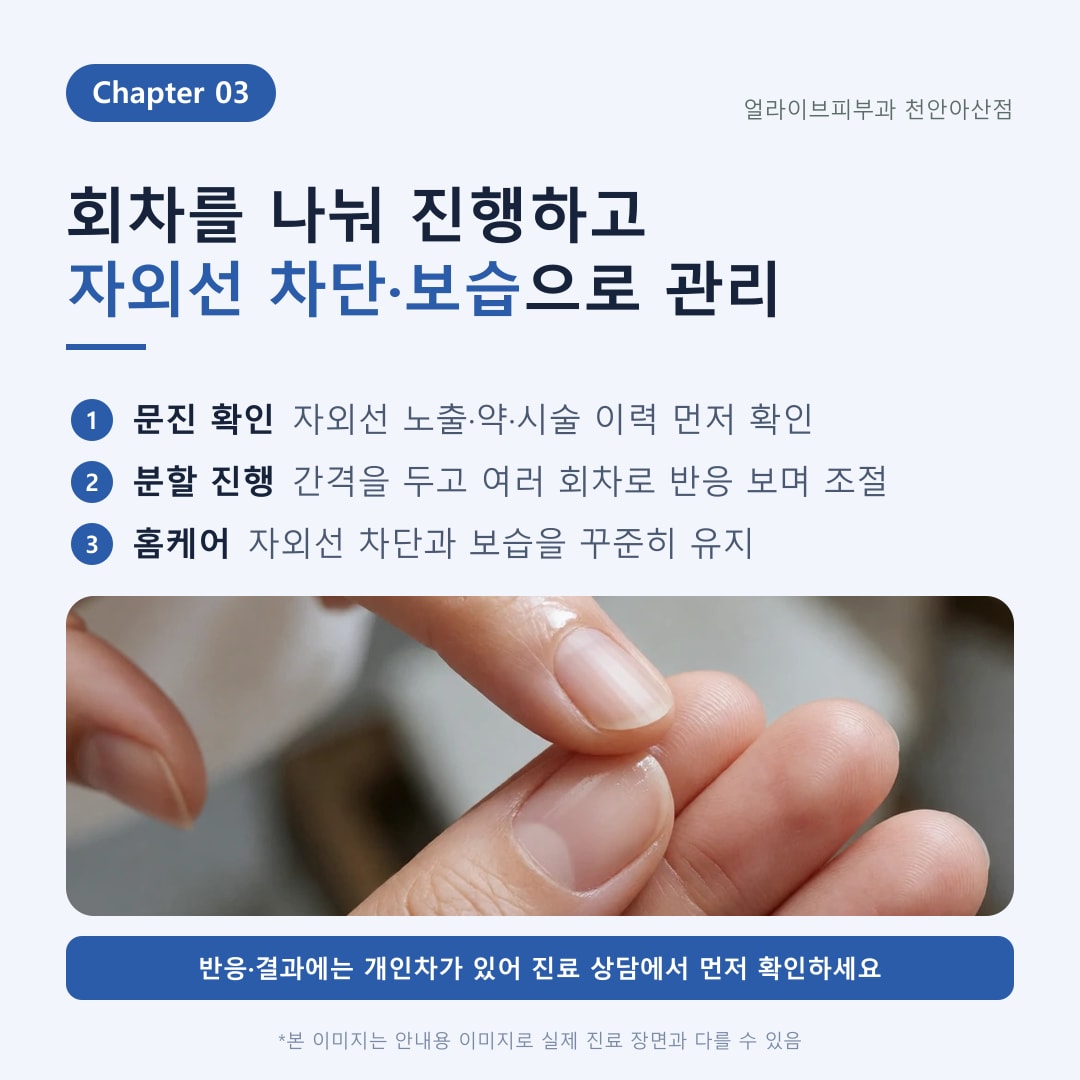 아산피부과 BBL레이저 색소·홍조 광선치료 안내 4