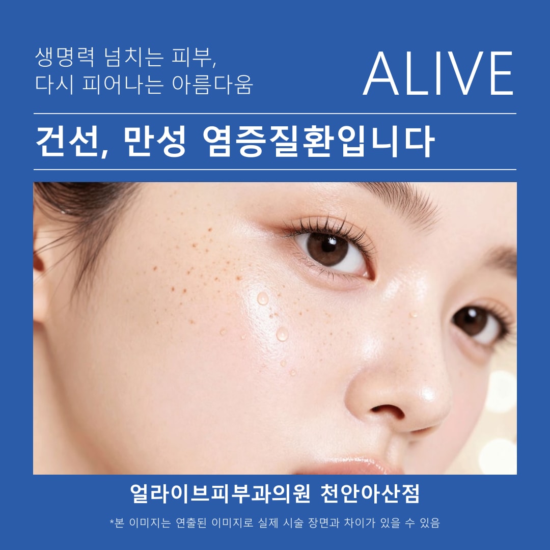 아산피부과 건선 진료 상담 안내 이미지