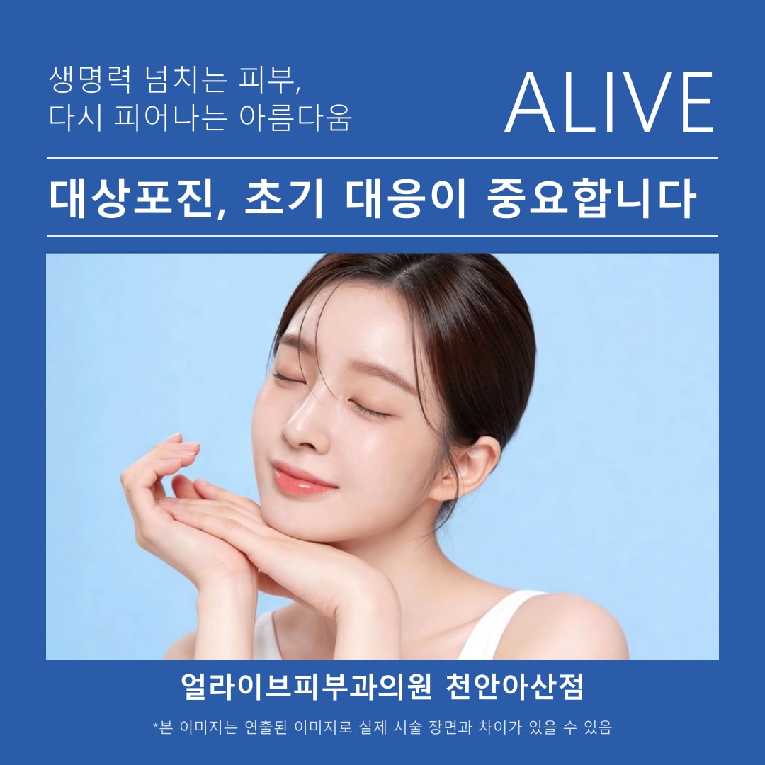 아산피부과 얼라이브피부과의원 천안아산점 대상포진 진료 상담 안내