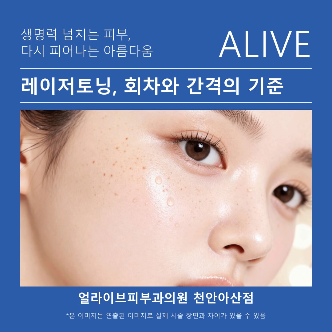 아산피부과 레이저토닝 상담에서 색소 종류와 깊이를 확인하는 진료 장면
