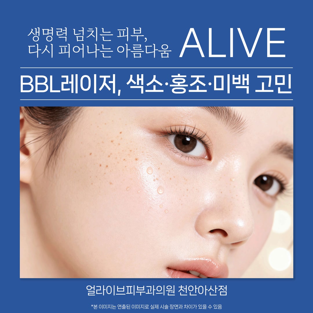 아산피부과 BBL레이저 상담 중 피부 색소 상태를 확인하는 모습